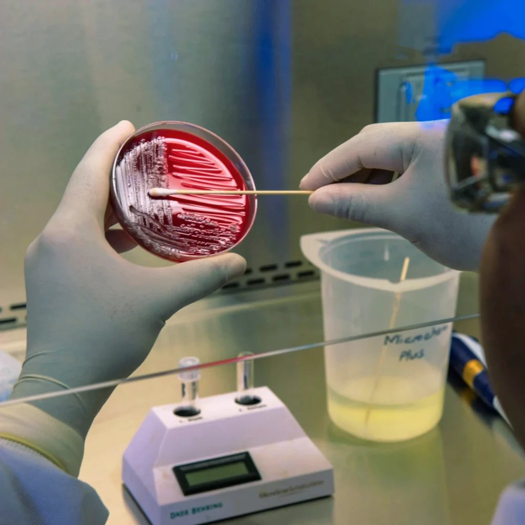 A petri dish of bacteria is it harmful to your health? 